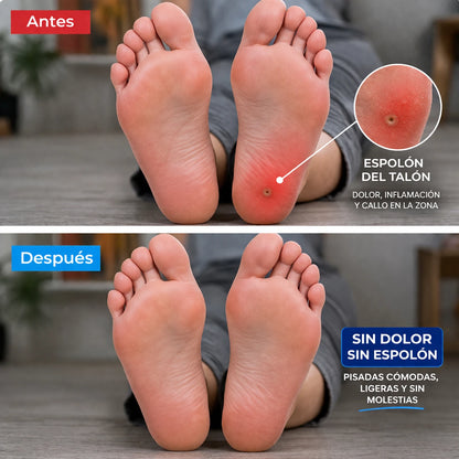 NeuroFoot™ - Plantillas para Espolón, Fascitis Plantar y Neuropatía