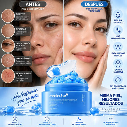 MediBlue - Gel de acido hialuronico de perlas azules