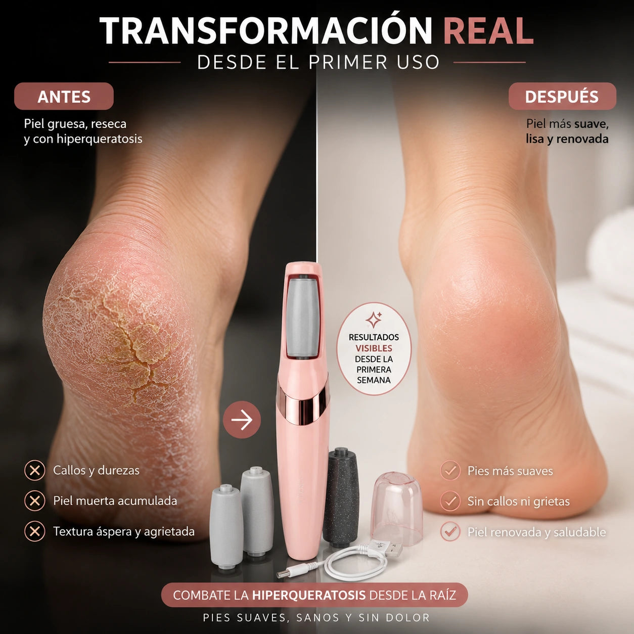 PediSoft - Removedor Callos, Piel muerta y Hiperqueratosis