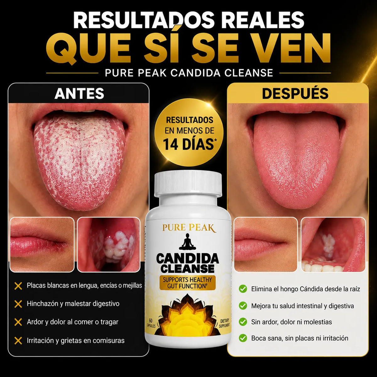 CandiClean - Elimina la Candida y esos kilos de más