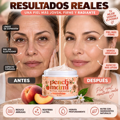 CreamFix - Crema Corporal Reafirmante