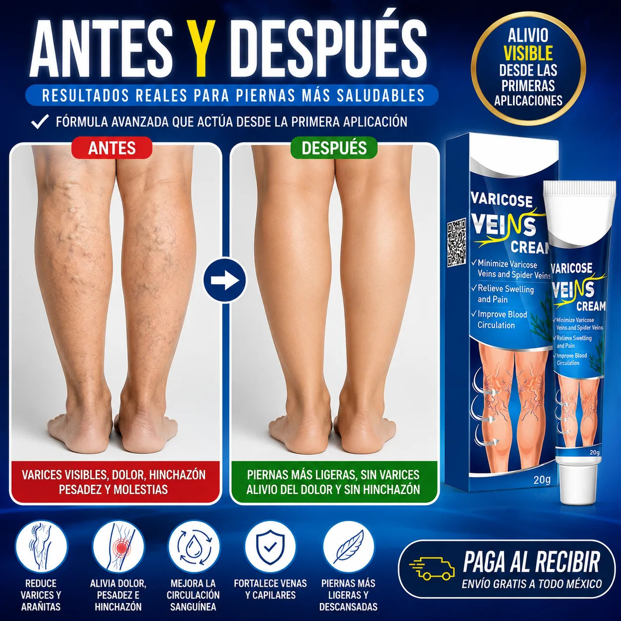 VariCream - Crema reductora de varices, para dolor y piernas hinchadas