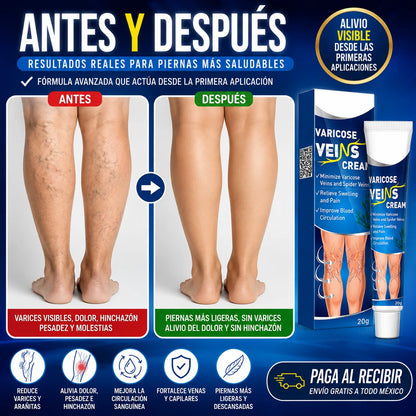 VariCream - Crema reductora de varices, para dolor y piernas hinchadas