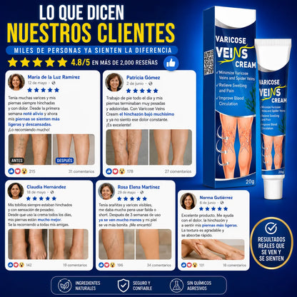 VariCream - Crema reductora de varices, para dolor y piernas hinchadas