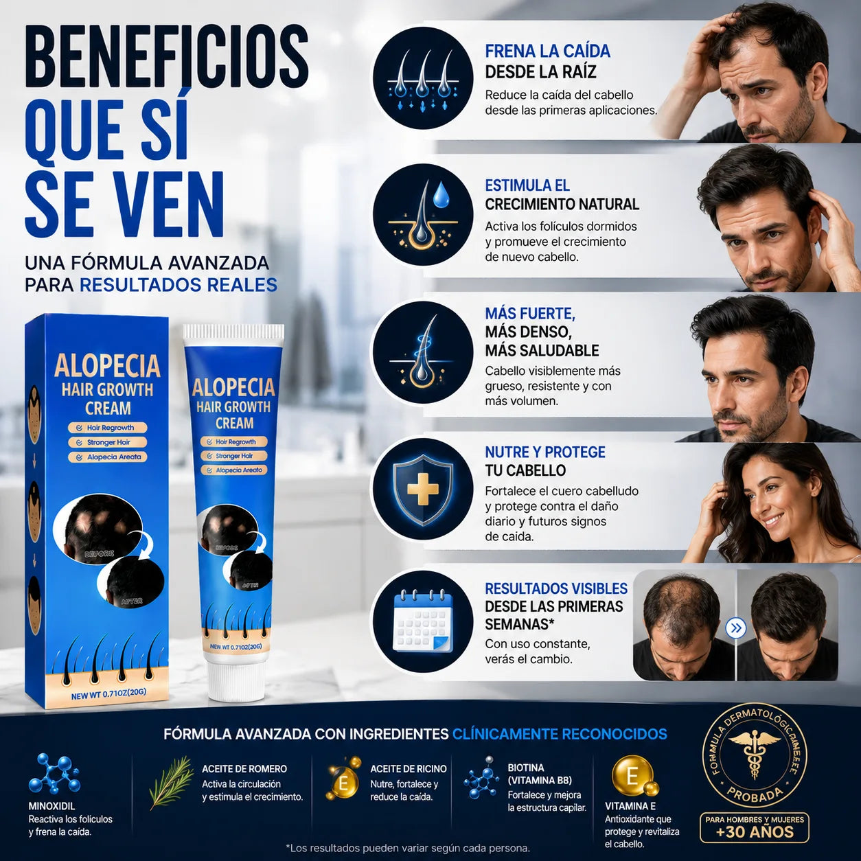 AlopeCacia™ - Tratamiento para Alopecia y Calvicie
