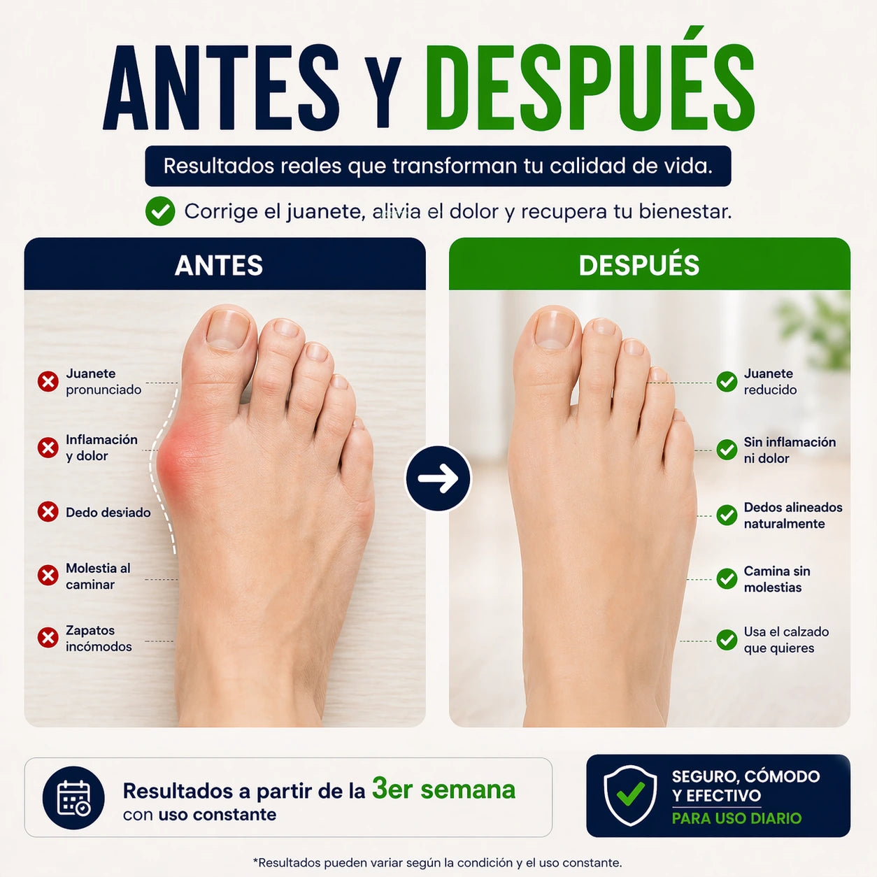 FootEasy™ Corrector de Juanetes