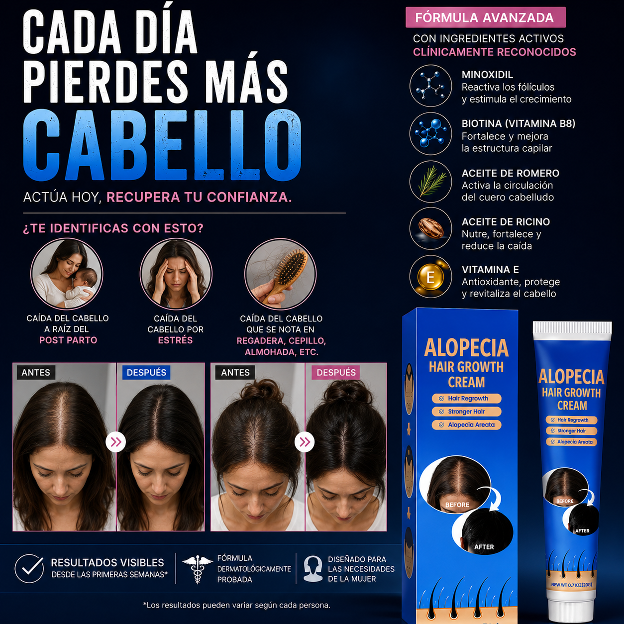 AlopeCacia™ - Tratamiento para Alopecia y Calvicie