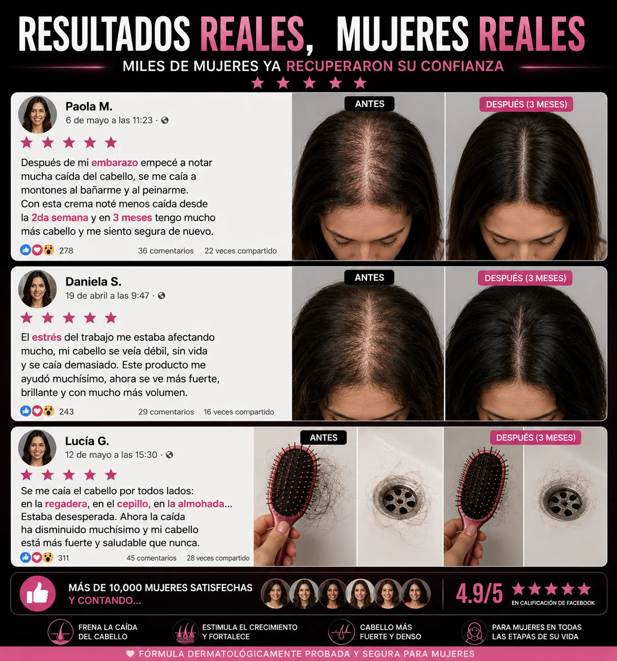 AlopeCacia™ - Tratamiento para Alopecia y Calvicie