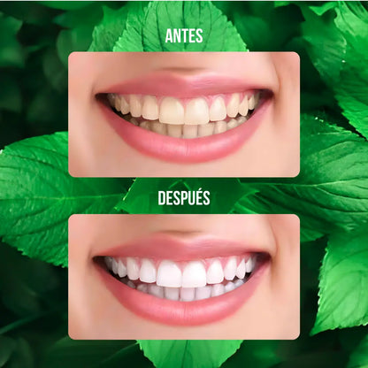Kit Pastillas Dentales "Caries + Sarro" 🦷